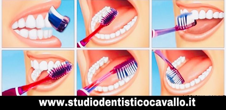 COME  LAVARE  CORRETTAMENTE  I  DENTI